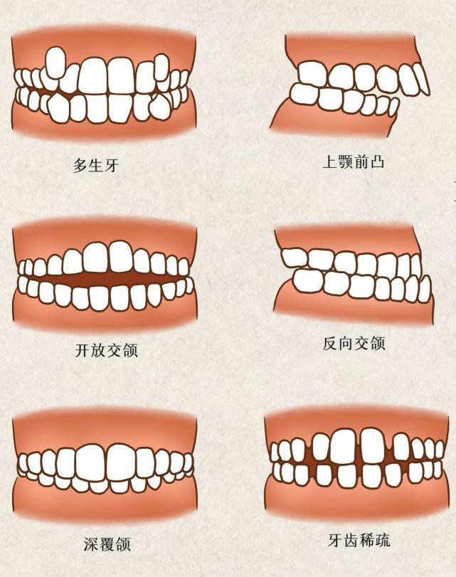 手机版畸形(畸形游戏怎么设置中文)